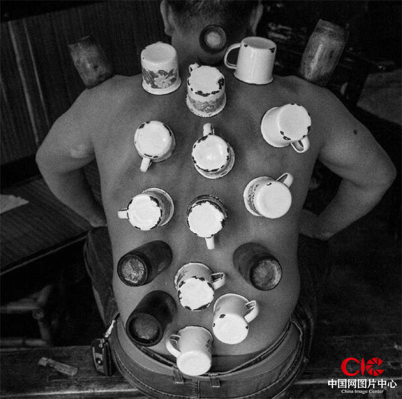 乌蒙山区内，叙永苗族自治县的一条老街上，很多从事苗族传统医药销售的苗医正在给客人“拔火罐”。